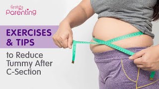 How to Reduce Tummy Fat After Csection Delivery Easy Exercises amp Tips [upl. by Ellehcear]