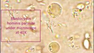 Blastocystis hominis parasite under microscope at 40X [upl. by Naharba329]