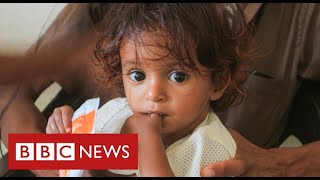 Yemen facing world’s “worst famine in decades”  BBC News [upl. by Yks818]