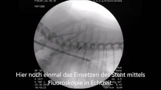 Trachealkollaps des Hundes  Diagnose amp Therapie [upl. by Enyawud99]