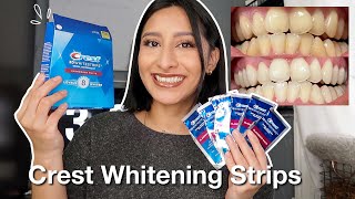 I TRIED THE CREST 3D WHITESTRIPS FOR 14 DAYS Effective  Before amp After pictures [upl. by Aciretehs]