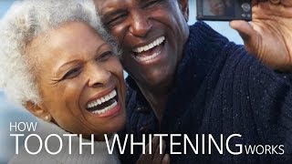 How Tooth Whitening Works [upl. by Guillermo]