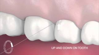 How to use interdental floss [upl. by Cordi]