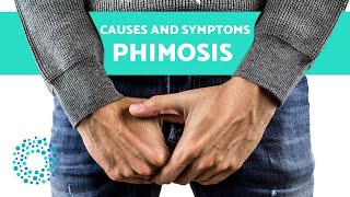 PHIMOSIS  CAUSES and SYMPTOMS [upl. by Ennasil]