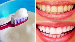 10 Natural Ways to Whiten Teeth at Home [upl. by Repinuj]