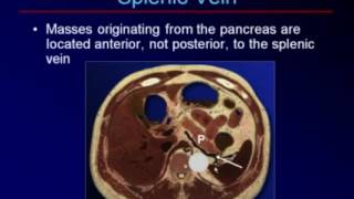 Sonography of the Pancreas and Spleen [upl. by Zarihs537]