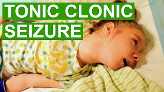 Tonic Clonic Seizure Video [upl. by Zaria]