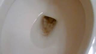 Simple trick to unclog unblock a toilet clogged up by excrement feces [upl. by Prinz]