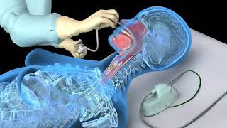 EMT skills Airway practical NREMT [upl. by Imas]