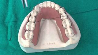 Peridontal Suturing Techniques [upl. by Ujawernalo]