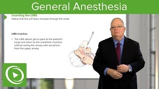 General Anesthesia – Anesthesiology  Lecturio [upl. by Ennaus]