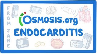 Clinicians Corner Endocarditis [upl. by Essej]