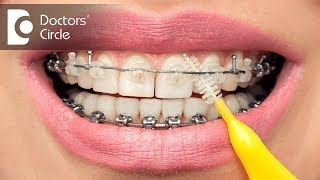 Ways to use an interdental brush  Dr Aniruddha KB [upl. by Waddell456]