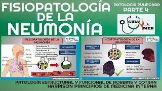 NEUMONÍA ADQUIRIDA EN LA COMUNIDAD FISIOPATOLOGÍA PARTE 1 GuiaMed [upl. by Norse466]