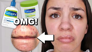 I Used Cetaphil Skincare For One Week [upl. by Hephzipah467]