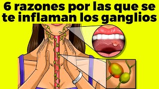 6 RAZONES POR LAS QUE SE TE INFLAMAN LOS GANGLIOS [upl. by Ibbison239]