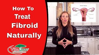 Best Foods To Shrink Fibroids  Health is Wealth [upl. by Cadman]