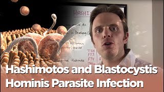 Hashimotos and Blastocystis Hominis Parasite Infection  The Infection Connection [upl. by Calia]