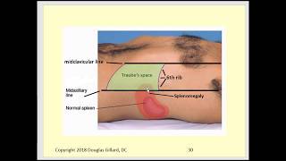 Palpation of the Liver amp Spleen [upl. by Ahsein]