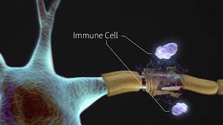 Gate Control Theory of Pain [upl. by Packston972]