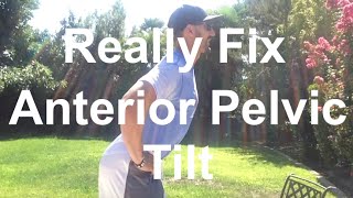 How to Really Fix Anterior Pelvic Tilt Hyperlordosis  Over Extension [upl. by Ecurb169]