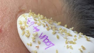 Satisfying With Loan Nguyen Spa Video 027 [upl. by Natasha]