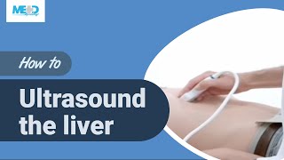 How to ultrasound the liver [upl. by Arahset140]