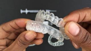 How to use Tooth Whitening Trays [upl. by Johns966]