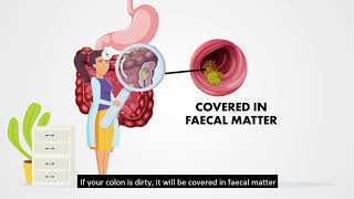 Colonoscopy Preparation  By NUH Colorectal Centre [upl. by Ahsaret]