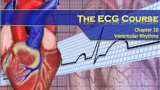 The ECG Course  Ventricular Rhythms [upl. by Dahl]