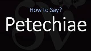 How to Pronounce Petechiae CORRECTLY Meaning amp Pronunciation [upl. by Eseeryt245]