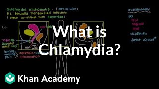 What is chlamydia  Infectious diseases  NCLEXRN  Khan Academy [upl. by Eiramyma]