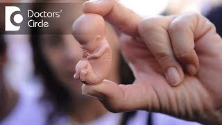 Why do Abortions or Miscarriages happen  Dr Apoorva P Reddy [upl. by Eolc905]