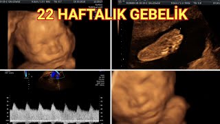 22 haftalık 5 aylık hamilelikte bebeğin ultrasonografi ve renkli Doppler görüntüleri açıklamalı [upl. by Cadmar]