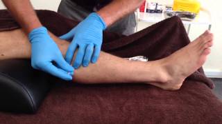 Dry Needling Peroneus Longus amp Brevis [upl. by Llennej]