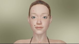 10 Ways To Remove Facial Skin Lesions [upl. by Zak754]