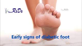 Early Signs of Diabetic Foot [upl. by Anaej]