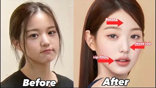 Ive Wonyoung EXTREME plastic surgery [upl. by Howell]