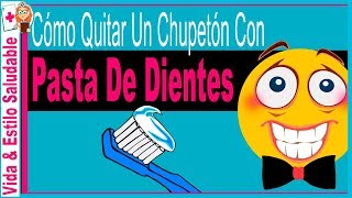 Cómo quitar un chupetón con Pasta De Dientes ✫ TRUCO que NO CONOCES FUNCIONA ❤ [upl. by Hayouqes722]