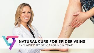 Medical Center Natural Cure for Varicose Veins  Top Vein Expert New York 10016 [upl. by Otanod]