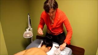 Acupuncture Demonstration and Benefits [upl. by Nalahs]