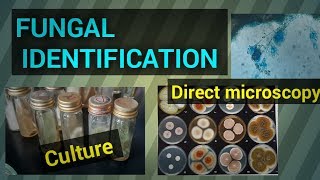 Fungal infectionFungal identificationFungal culture test procedureFungal diseaseSTAR LABORATORY [upl. by Nellahs]