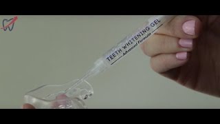 Teeth Whitening Syringe and Tray Instructions [upl. by Niamjneb419]