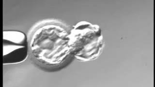 Day 5 full hatched blastocyst under microscope [upl. by Teeter]