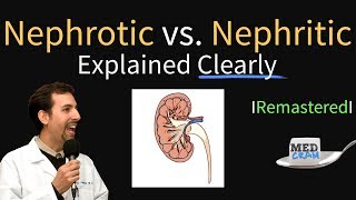 Nephrotic vs Nephritic Syndrome Proteinuria Hematuria Casts [upl. by Yennek]