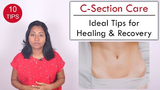 10 Tips to help Heal C Section wound  Post Delivery Care [upl. by Aztin]