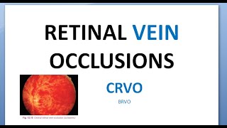 Ophthalmology CRVO Central Retinal Vein Occlusion Splashed tomato Thunder Ischemic RAPD glaucoma [upl. by Assilem839]