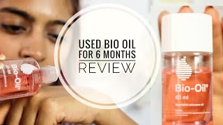 Bio Oil Review  Does Bio Oil Work on Stretch Marks amp Scars  SuperWowStyle [upl. by Jacobson]