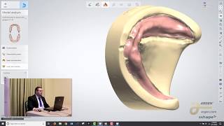 Digital Dentures A Crash Course on How to Design using 3Shape  Logan Woomer [upl. by Une]