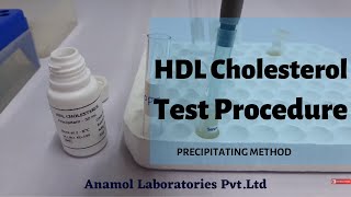 HDL Metabolism  Reverse Cholesterol Transport  HDL Metabolism Biochemistry [upl. by Nylaj661]